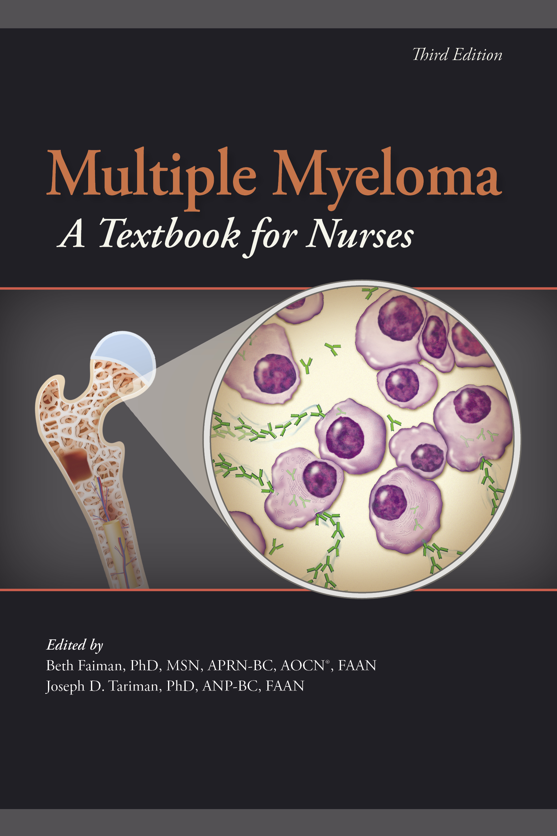 Multiple Myeloma 3rd edition